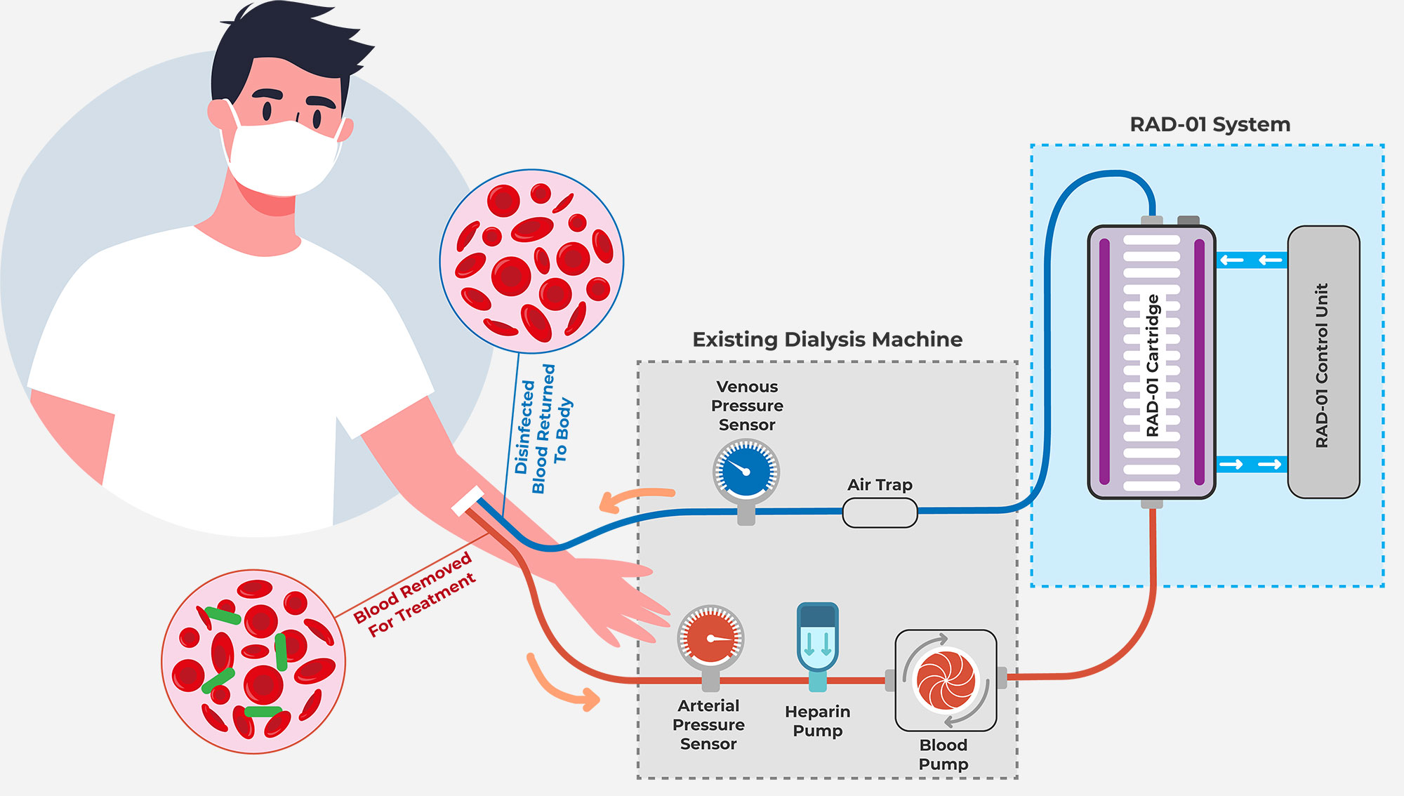 Diagram showing components of Radiatric RAD-01 system.